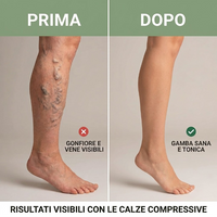 Reviita Leg Comfort - calze a compressione per gambe leggere